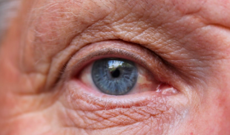 The right Vitamin B12 dosage for seniors may reduce Macular Degeneration