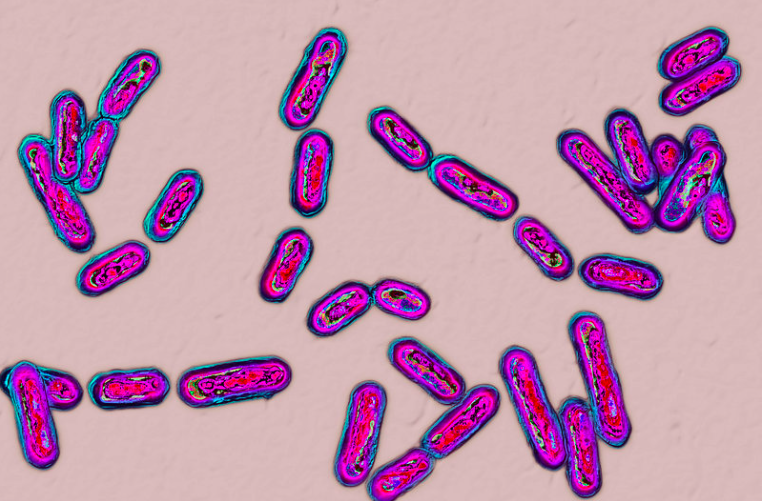 What does C diff smell like? These bacteria can give you the worst smelling poop ever
