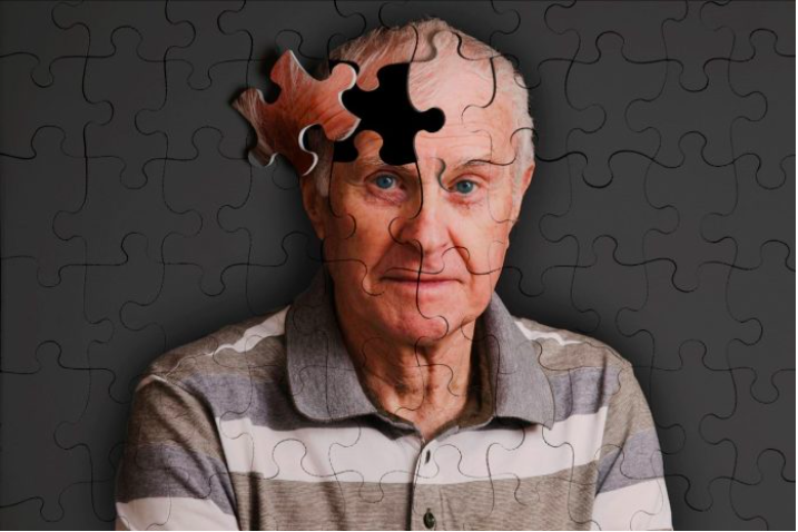 Picture of old person with a puzzle piece missing in his head, symbolizing Alzheimer's